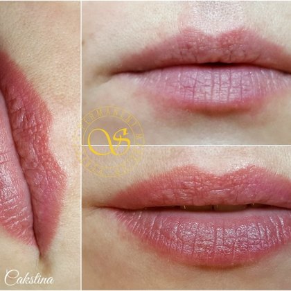 Lūpas sadzijušas permanentais grims