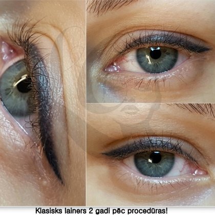 Acu permanents, lainers