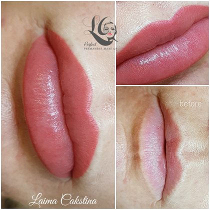 Tempera lips uzreiz pēc procedūras. Lūpu mikropigmentācija