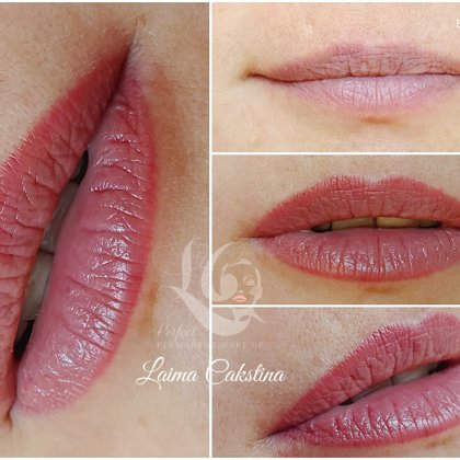 Tempera Lips sadzijis pēc 1 procedūras#lūpupermanents#