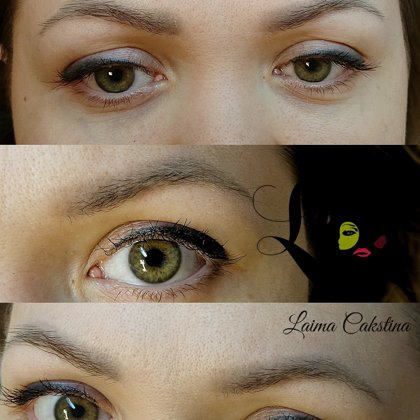 #permanentāsuzacis#2,5 gadi pēc procedūras