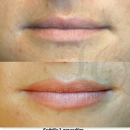 Tempera Lips nude stilā, sadzijis