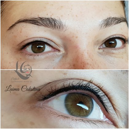 Starpskropstu zonas aizpildīšana