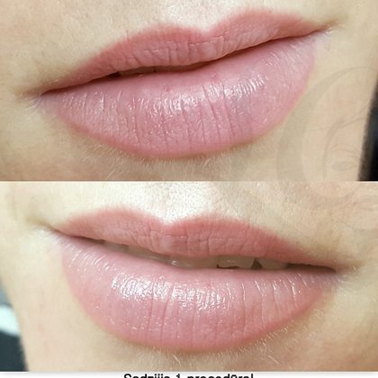 Микропигментация губ, после заживления