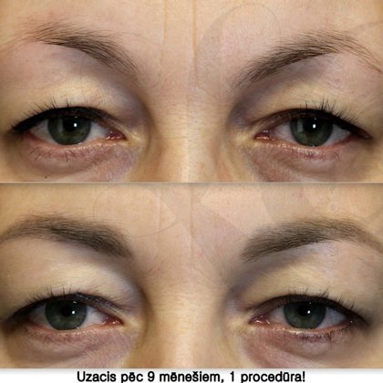 Перманент бровей, после заживления