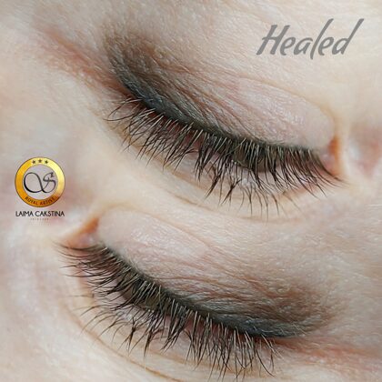 #permanent##permanentasacis#