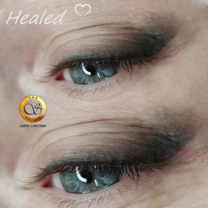 #mikropigmentācijaacīm##acupermanentaisgrims#