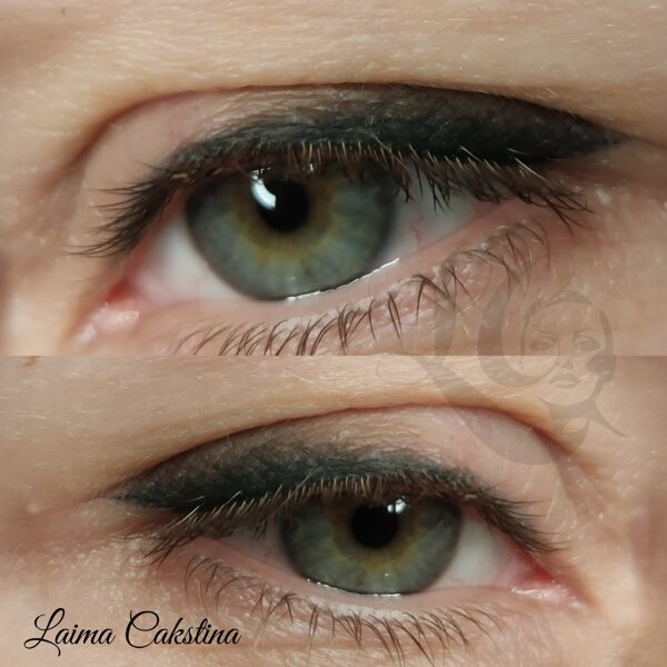 #mikropigmentācija#