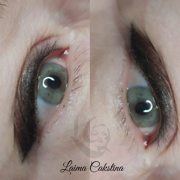 #mikropigmentācija#