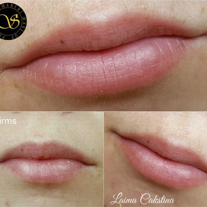 Tempera Lips, permanent healed