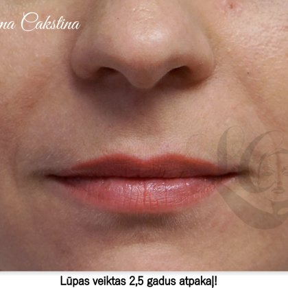 Permanent makeup lips, work done 2,5 Years ago