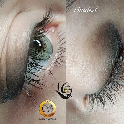 #permanentaisgrims##healedeyes#