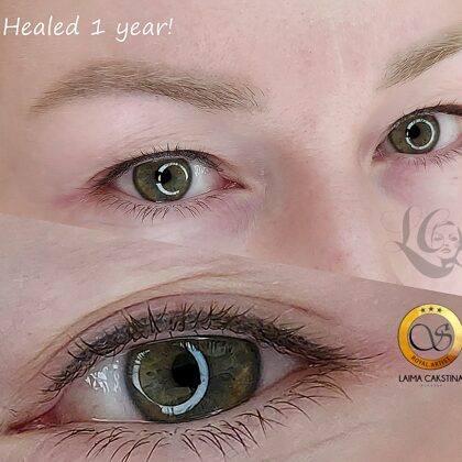 #mikropigmentācijaacīm##rezultāts pēc 1 gada