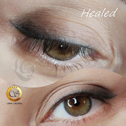 #mikropigmentācijaacīm##permanentaisgrimsacīm#