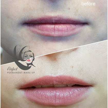 Lips micropigmentation, healed ''nude"