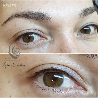 #permanentaisgrims#healed