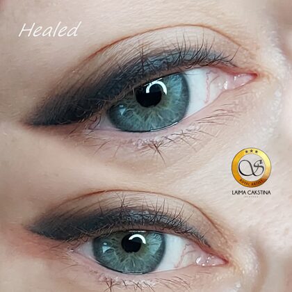 #acupermanents##mikropigmentācija##sadzijislaineris#