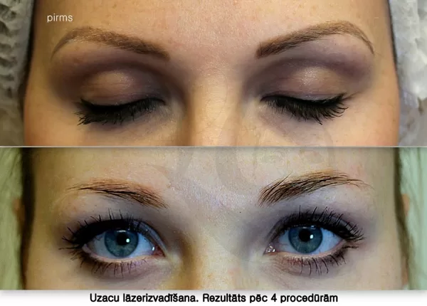 #permanentāgrimanoņemšana##uzacukorekcija#