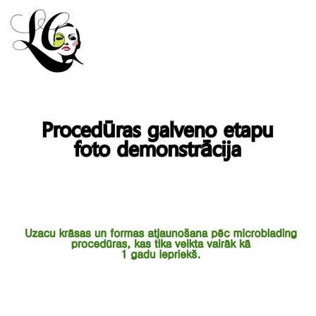 Procedūras galveno etapu foto demonstrācija
