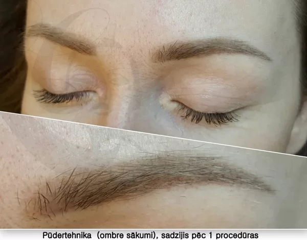 Uzacis pūdertehnika sadzijis rezultāts