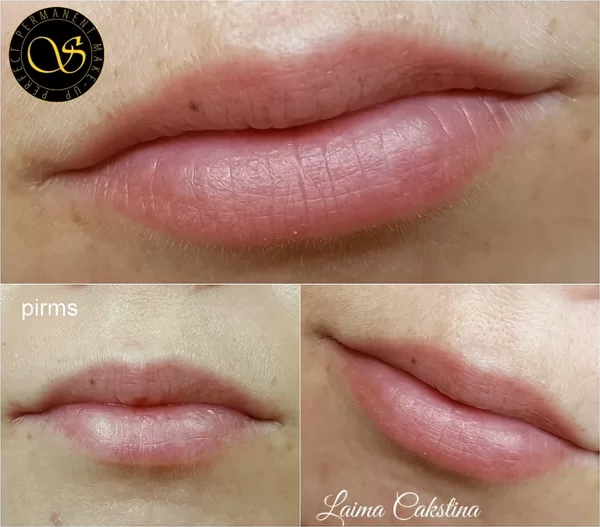 Tempera Lips, permanent healed