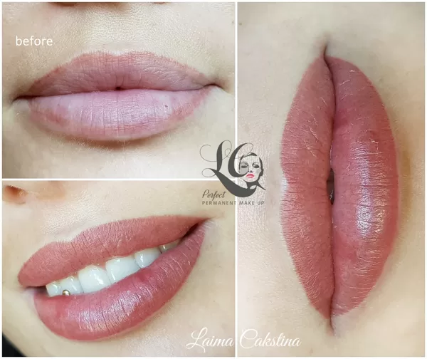 Correction work immediately after procedure, permanent lips