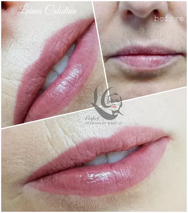 Tempera Lips, healed, before little correction