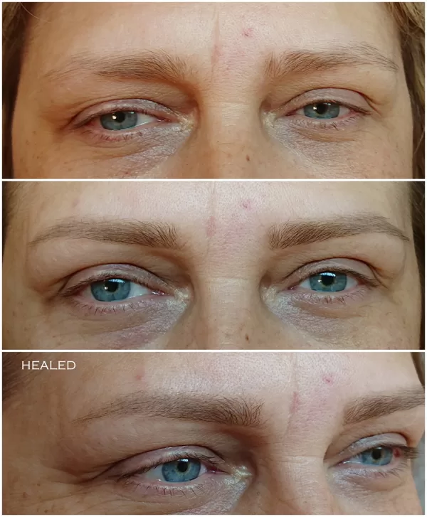#permanentāsuzacis#healed#Airy Powder