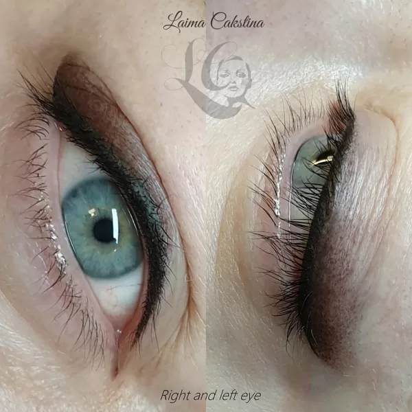#acupermanents# immediately after