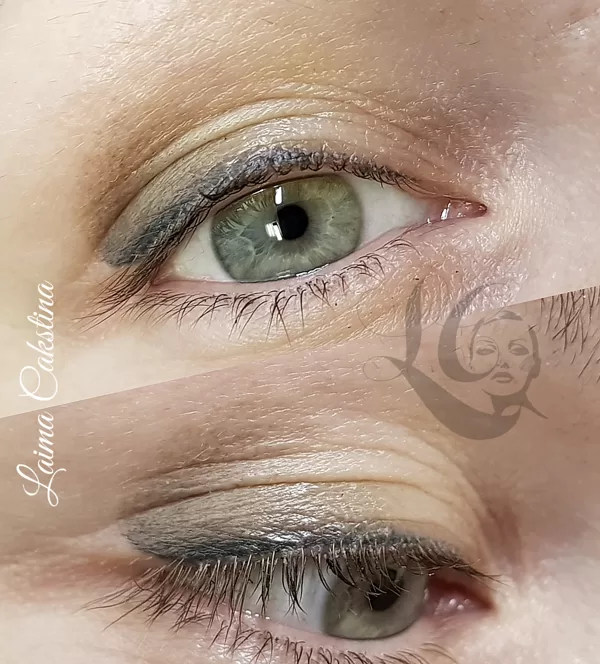 Eye permanent, healed